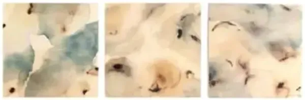 Nostalgia Underneath Set Wall Art